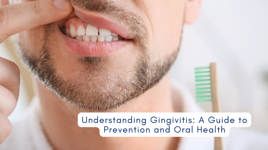 Understanding Gingivitis A Guide To Prevention And Oral Health 2023