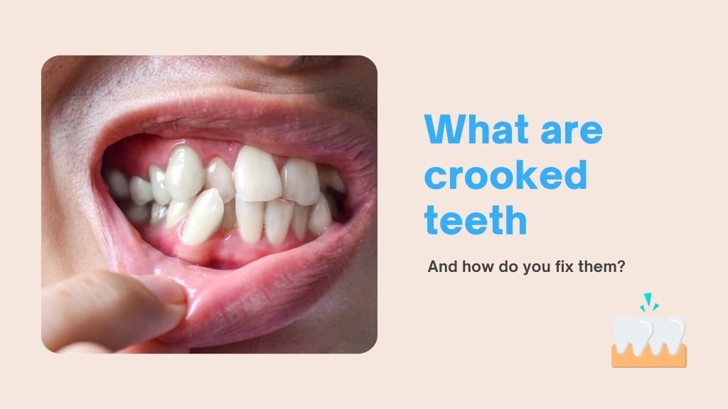 Crooked Teeth