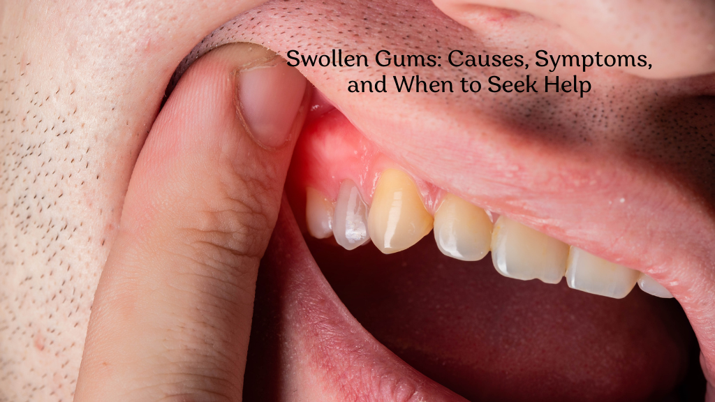 Swollen Gums